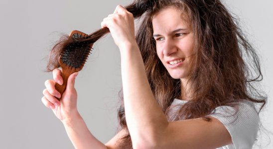 chute des cheveux